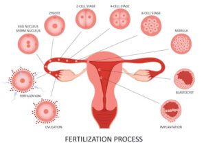 Female Infertility