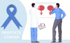 Pancreatic Cancer